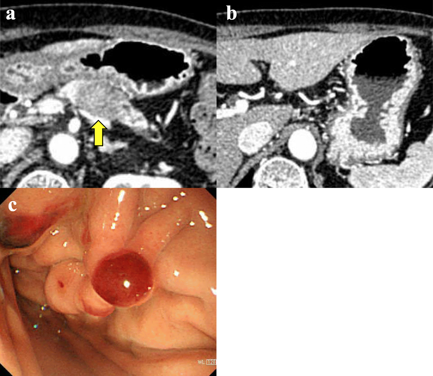 Fig. 1