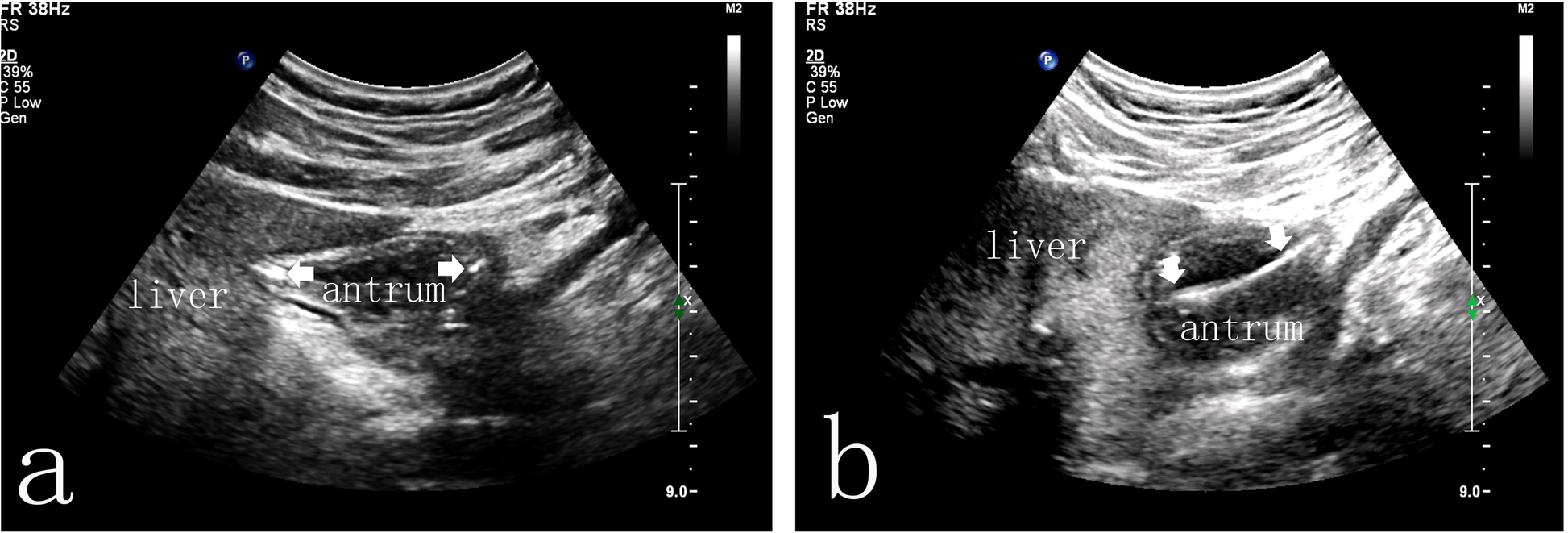 Fig. 3