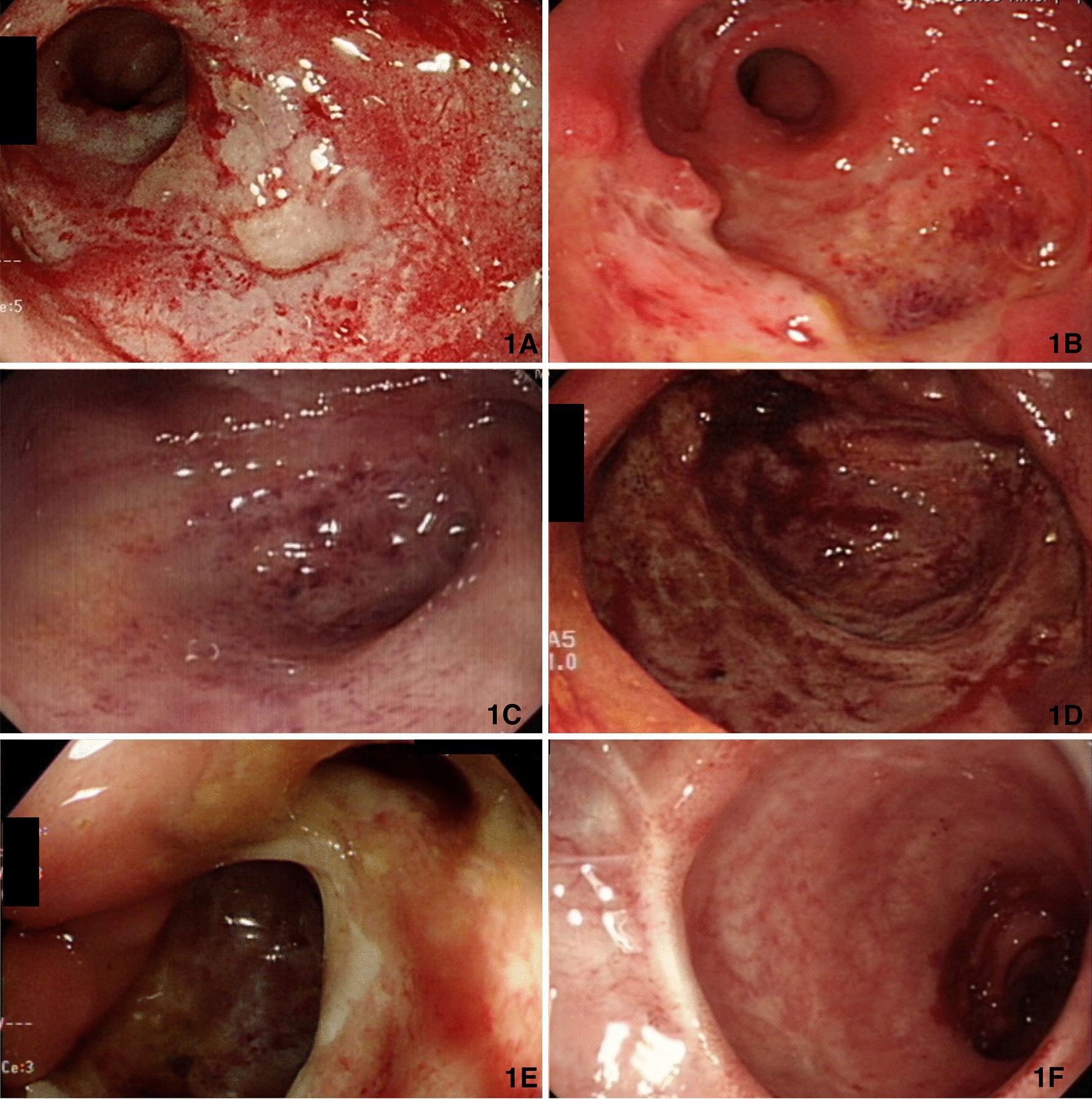 Fig. 1