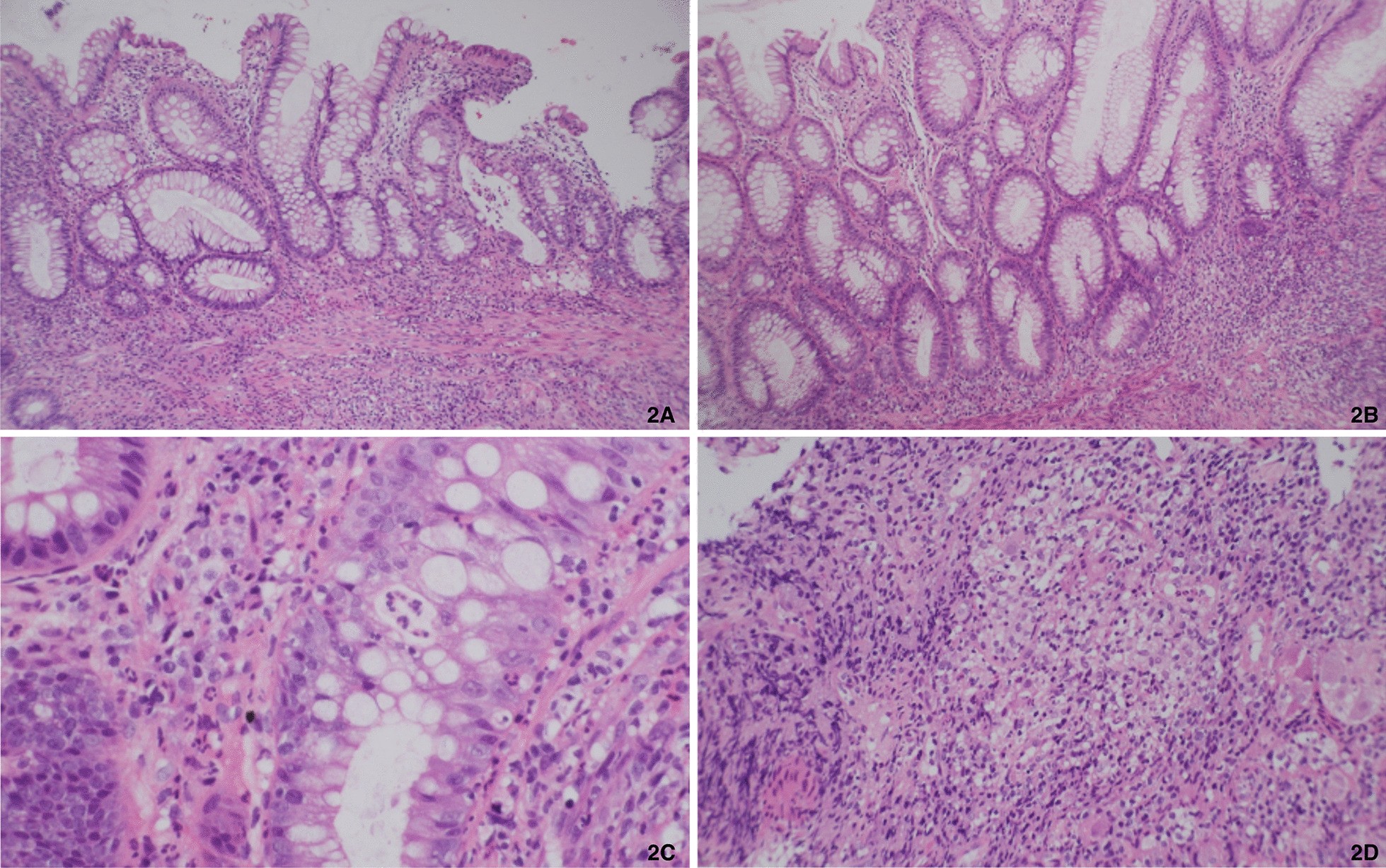 Fig. 2