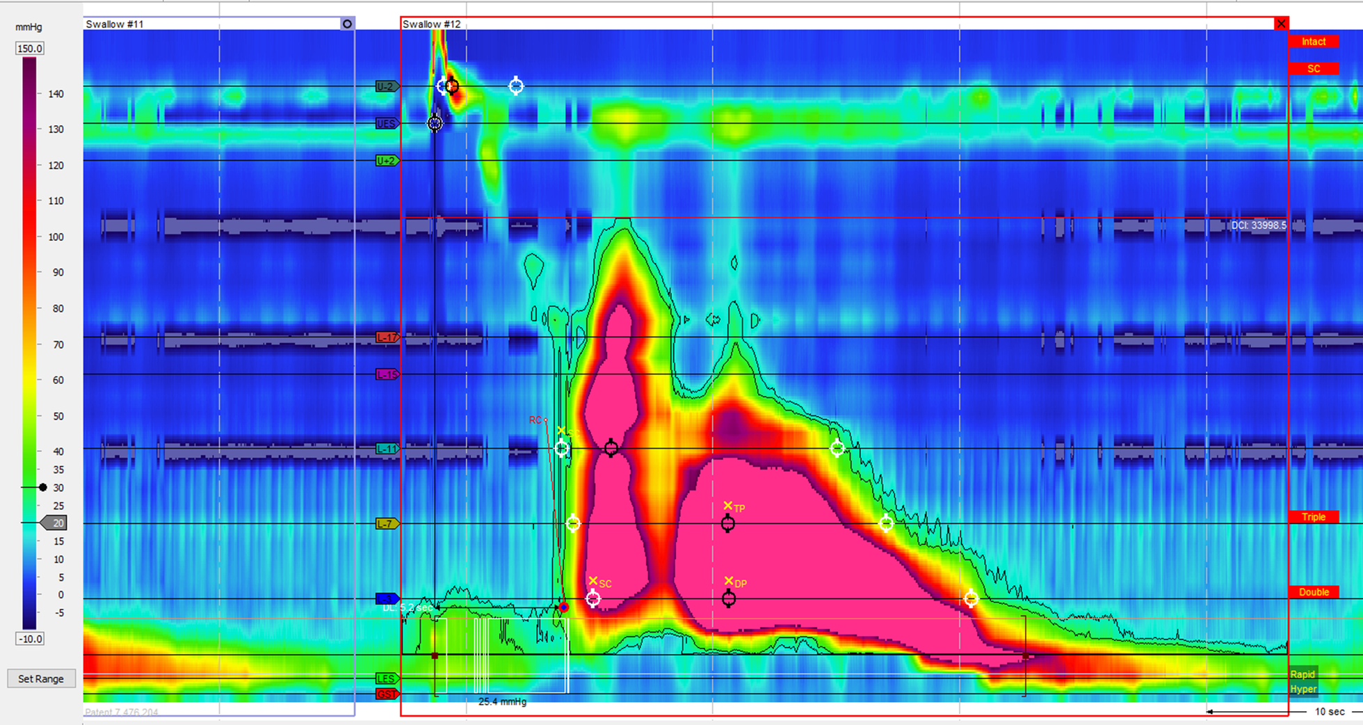 Fig. 3