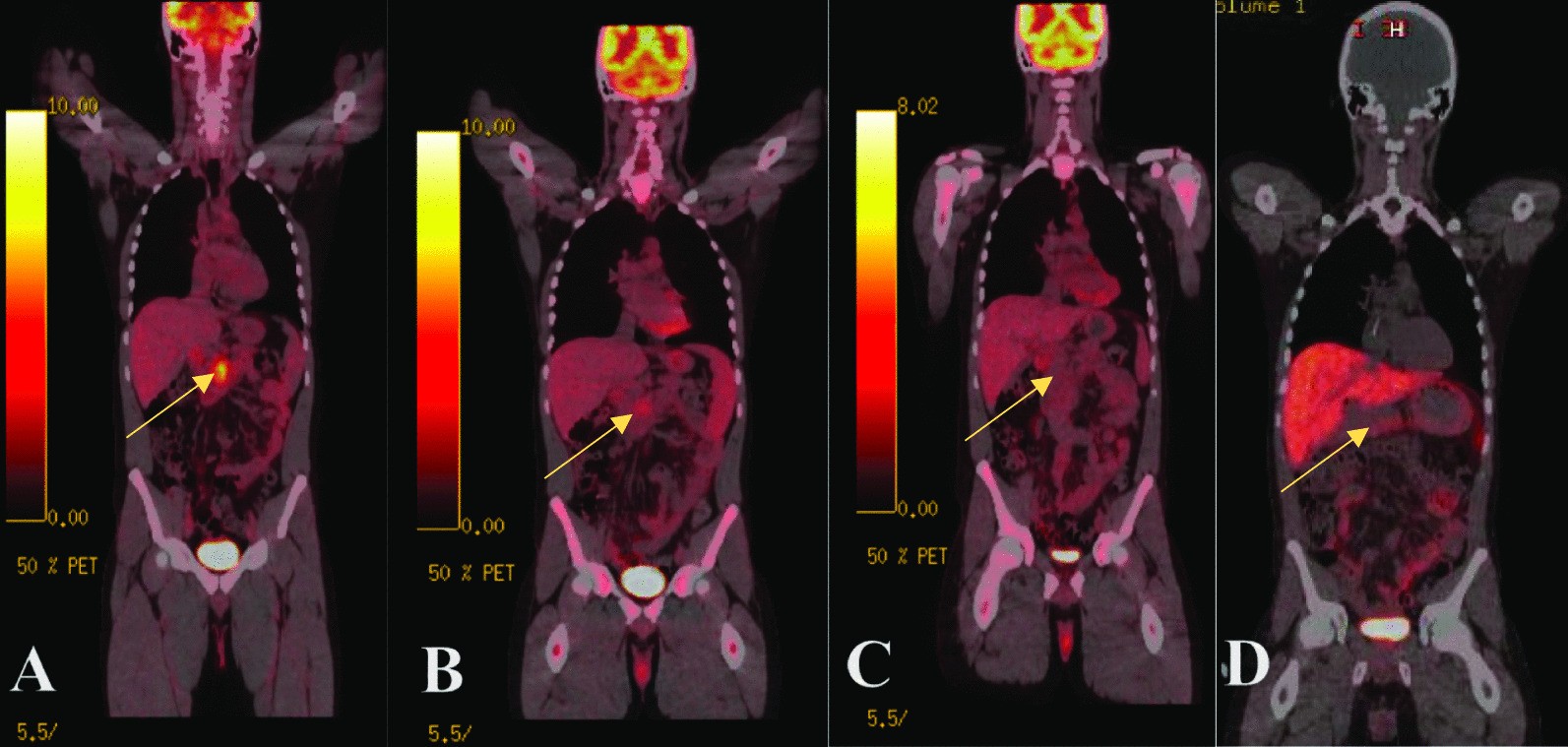 Fig. 4