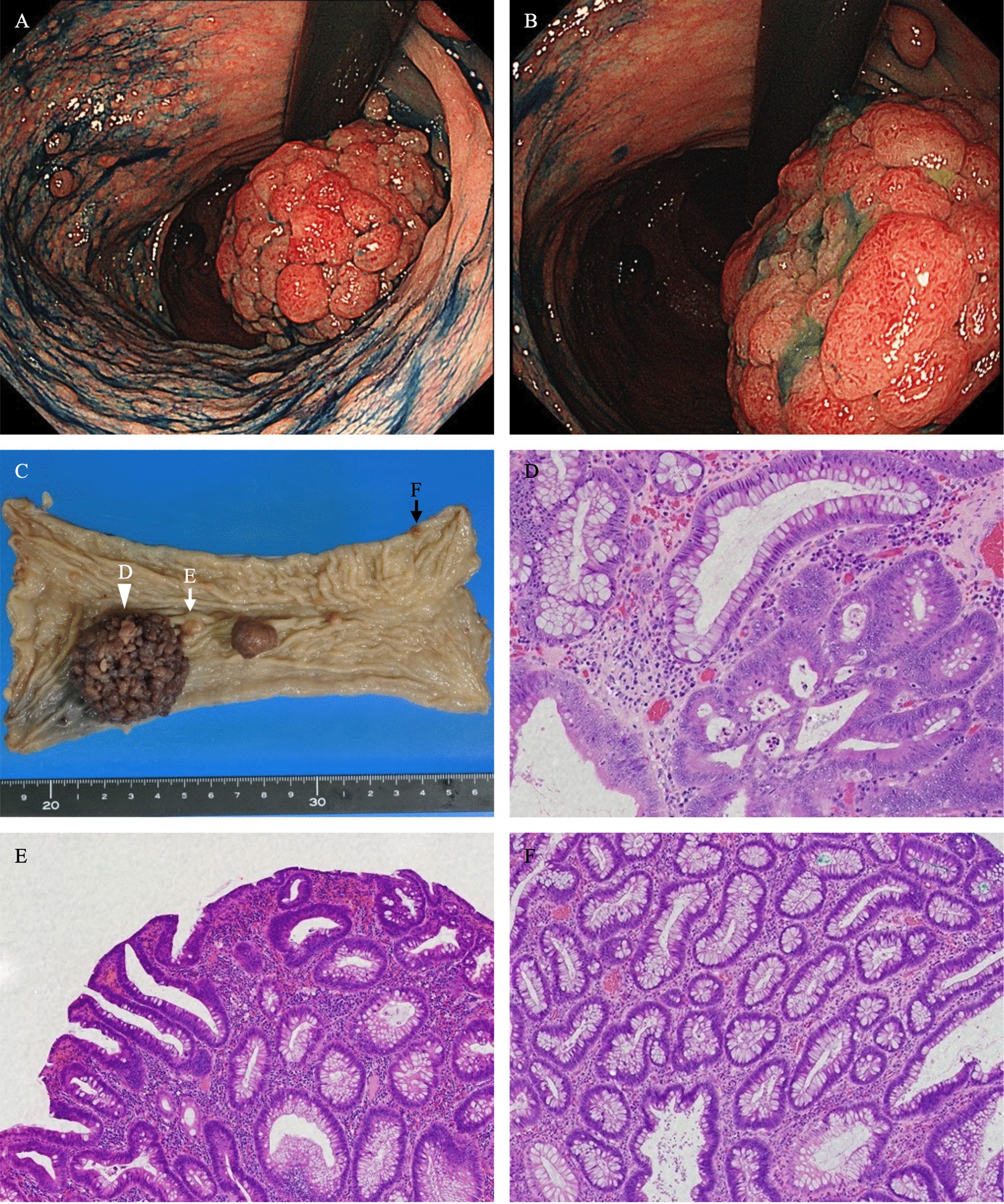 Fig. 2