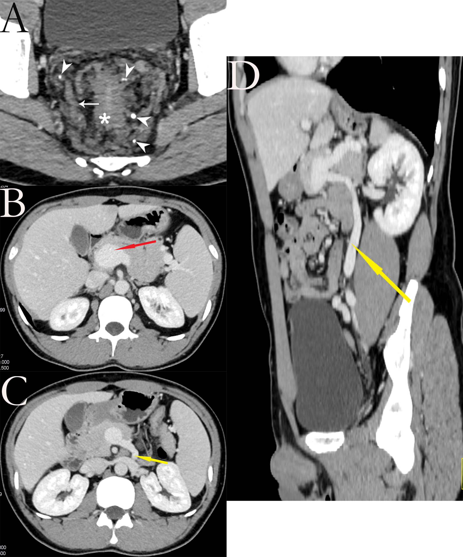 Fig. 1