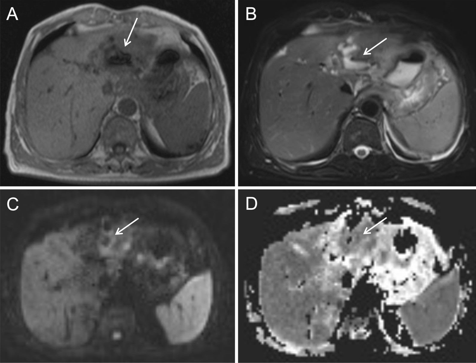 Fig. 10