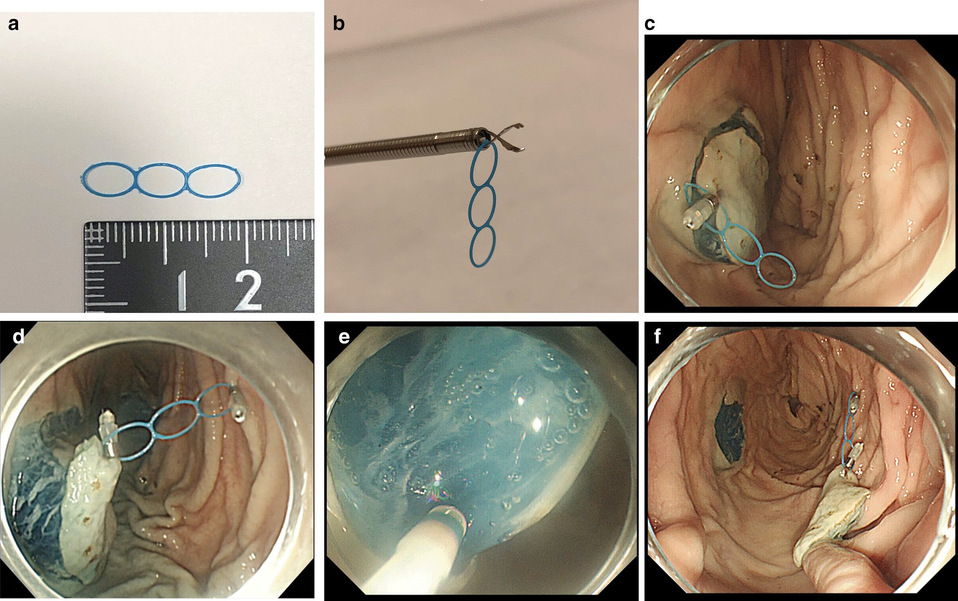 Fig. 1