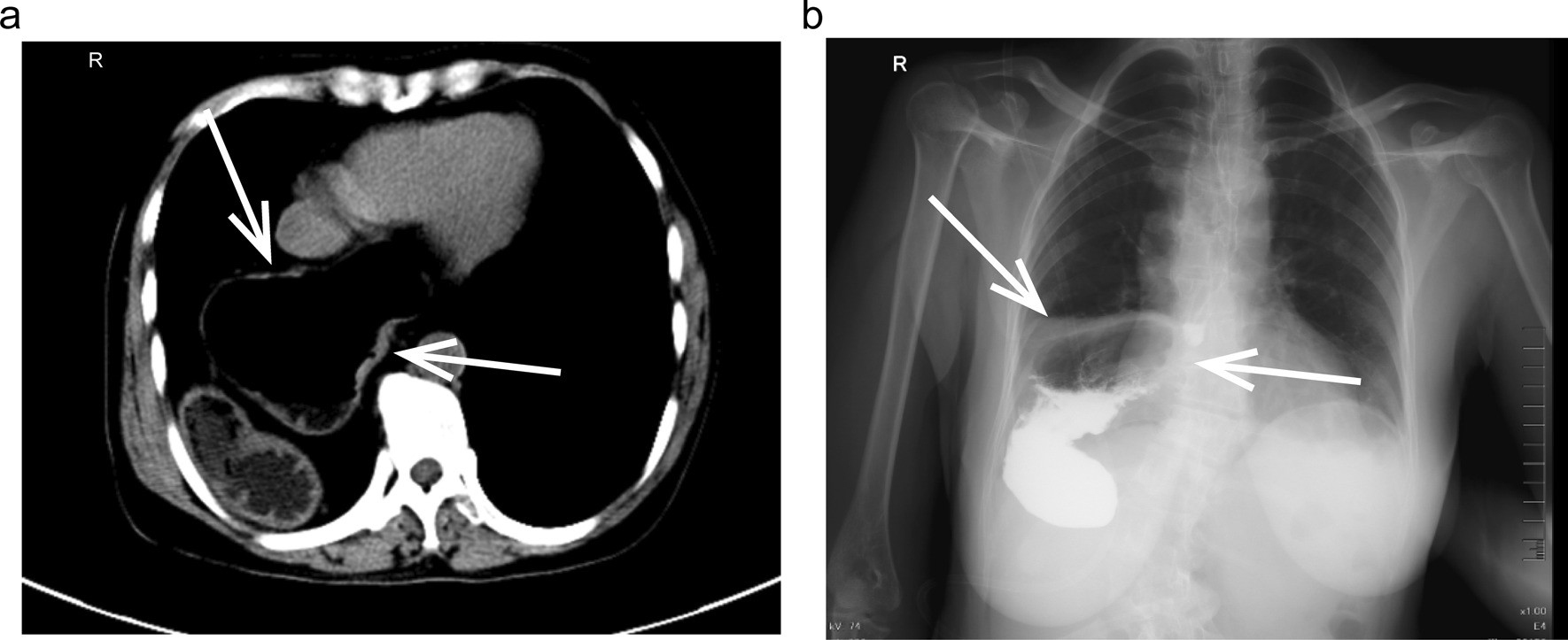 Fig. 1