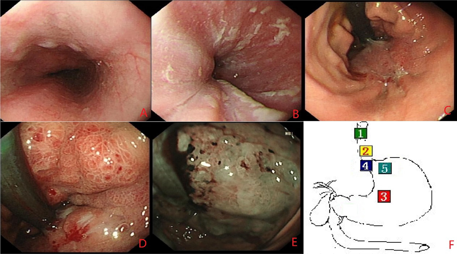 Fig. 1