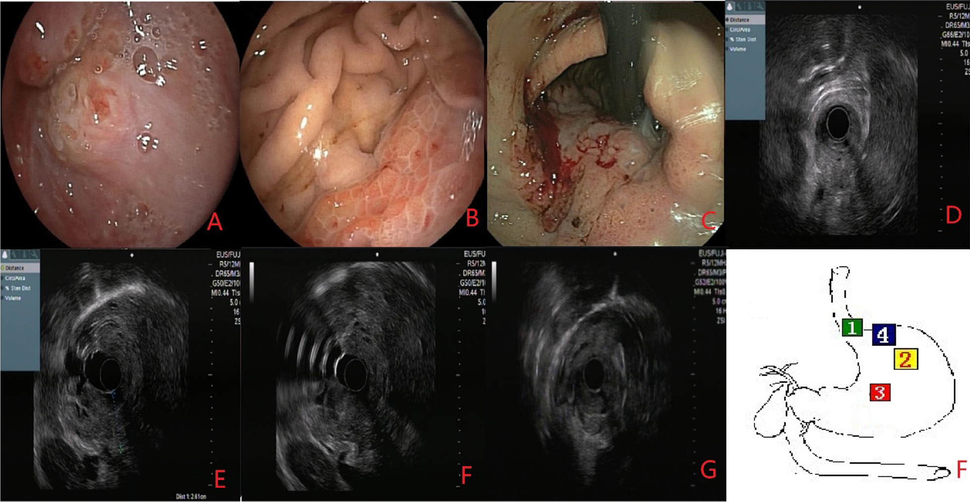 Fig. 3