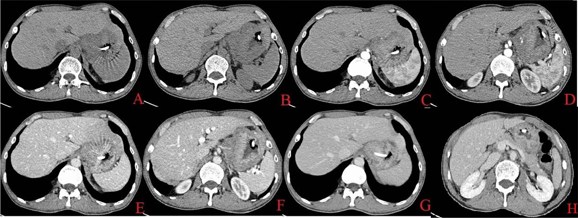 Fig. 4