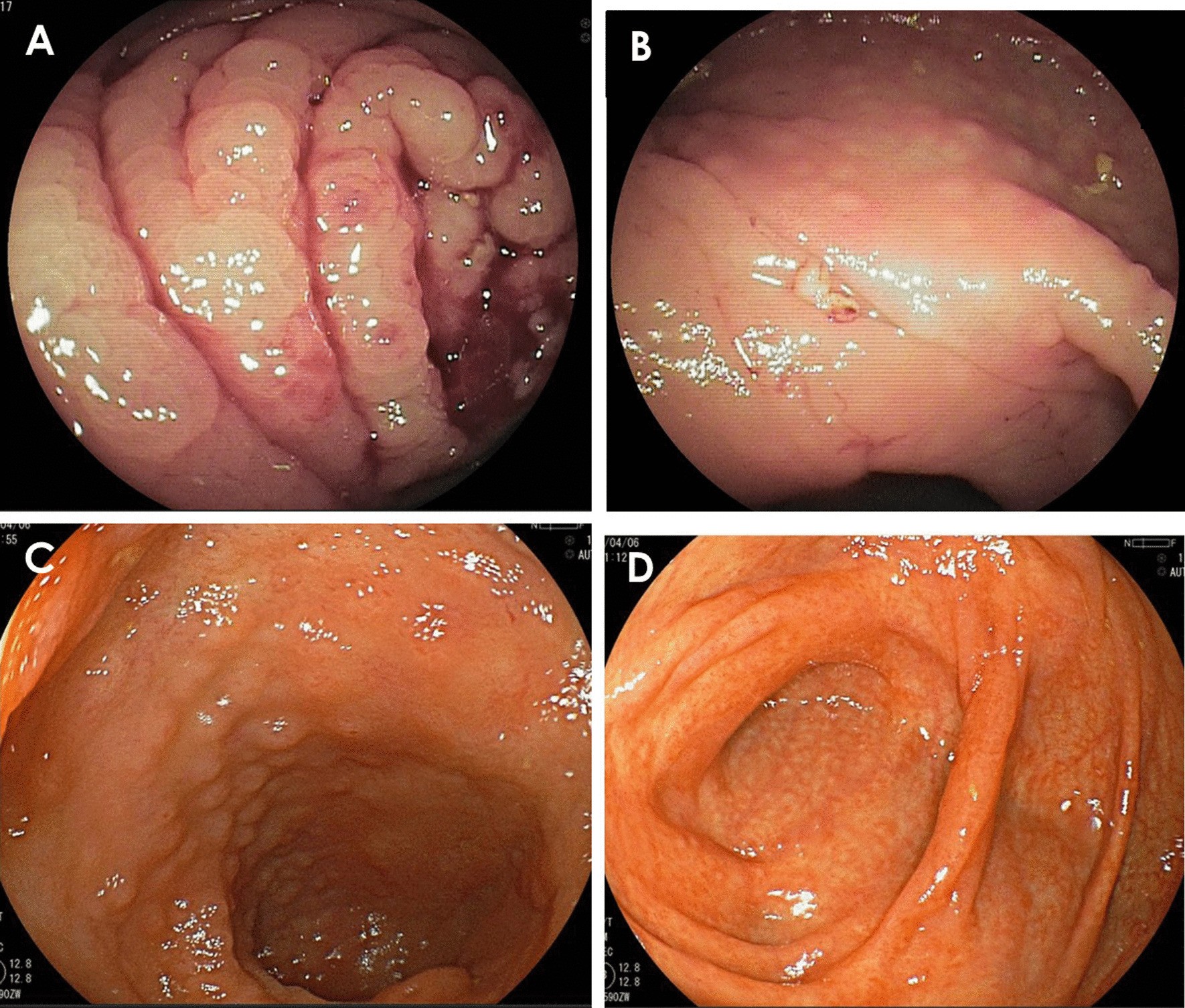 Fig. 3