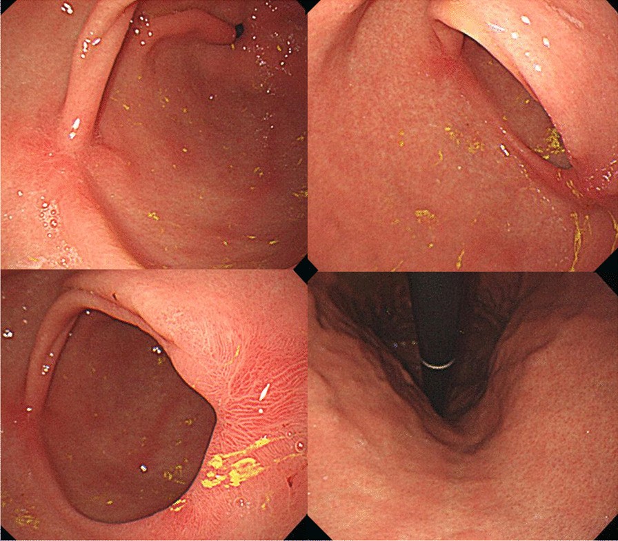 Fig. 2