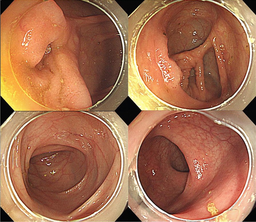 Fig. 4