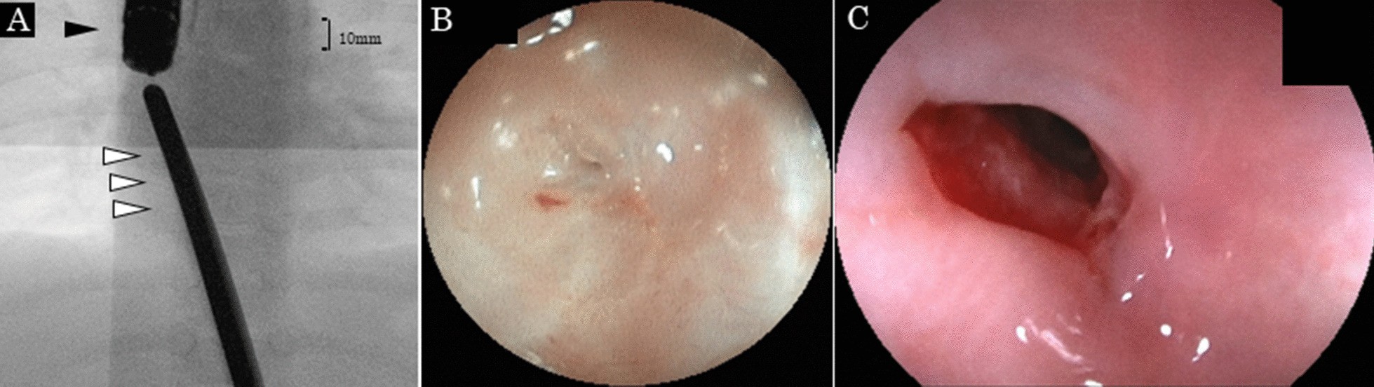 Fig. 2