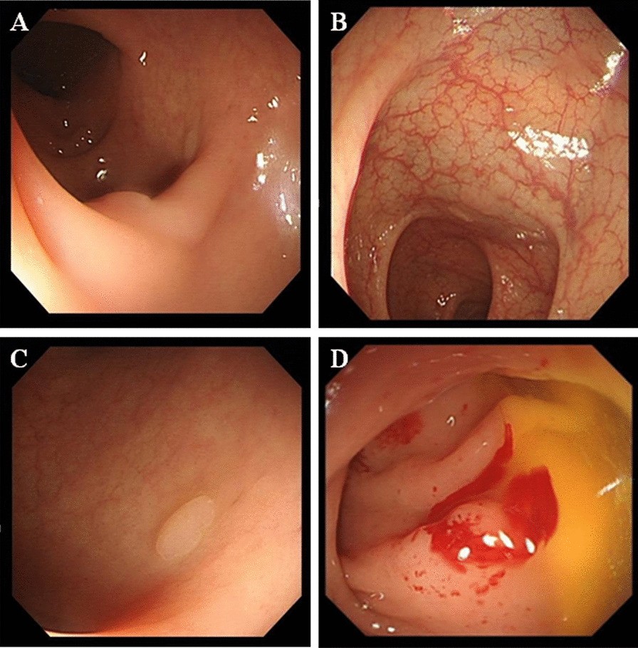 Fig. 1