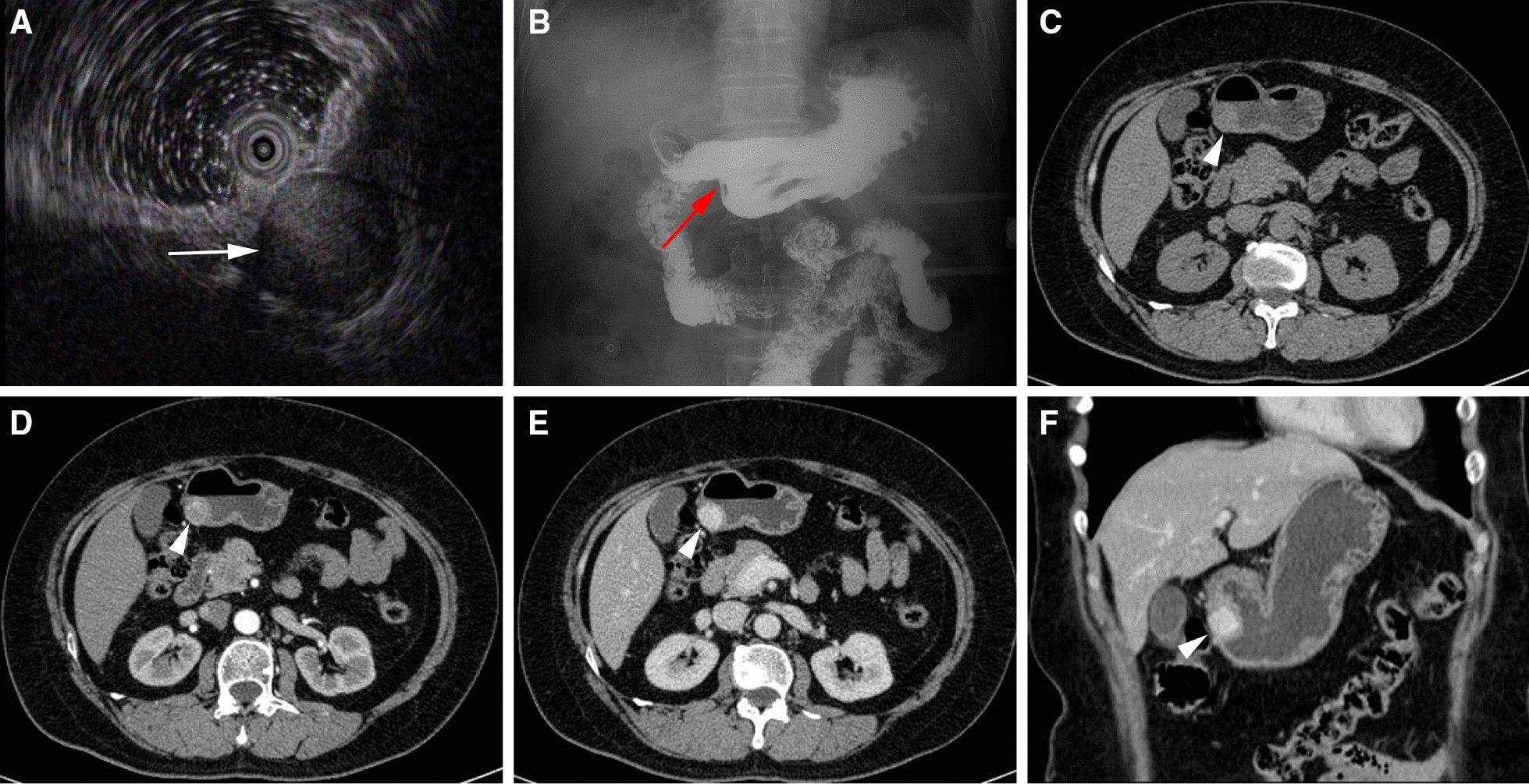 Fig. 1