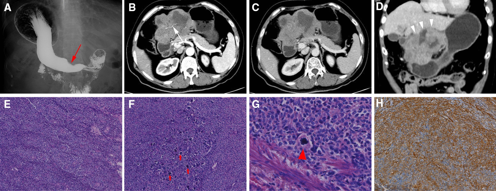 Fig. 2