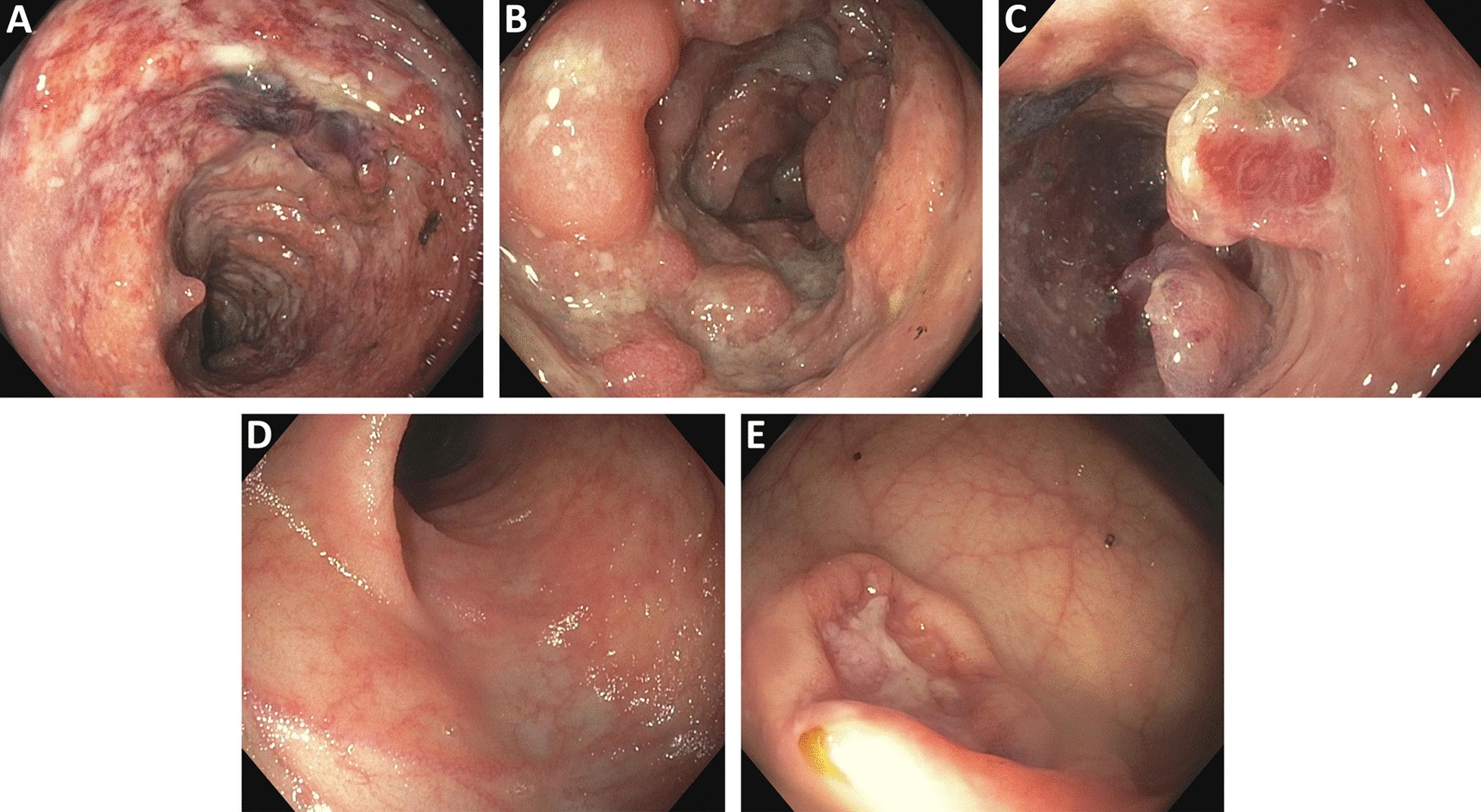 Fig. 2