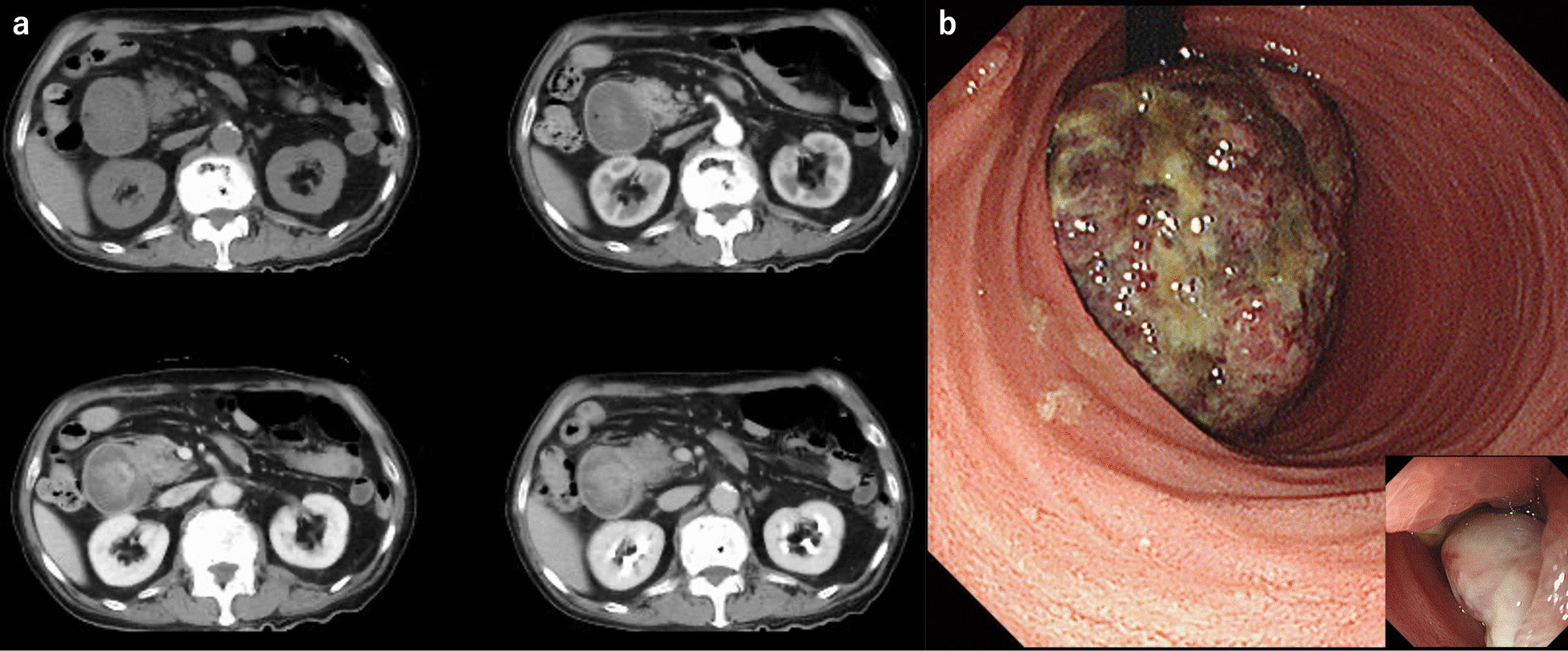 Fig. 1