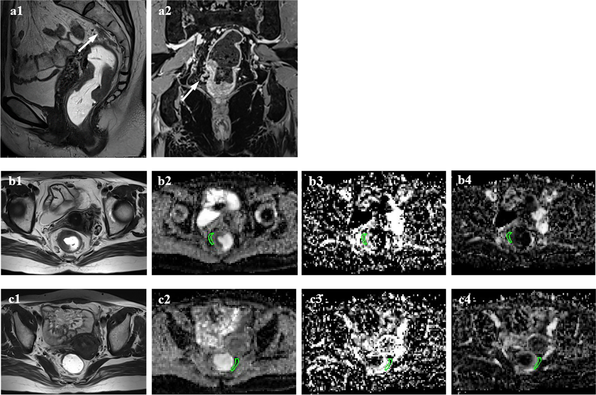 Fig. 4