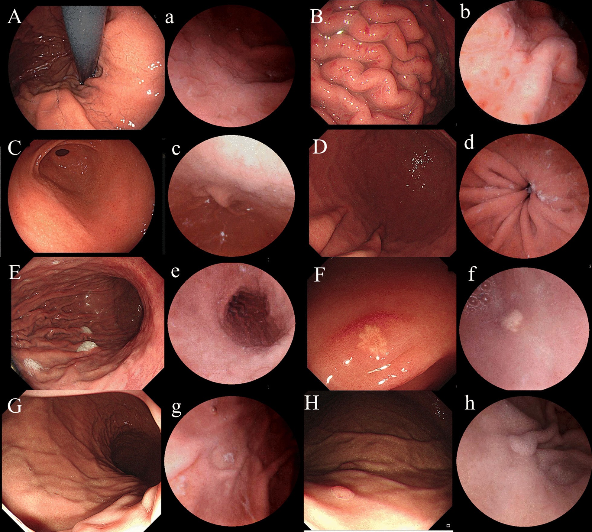 Fig. 1