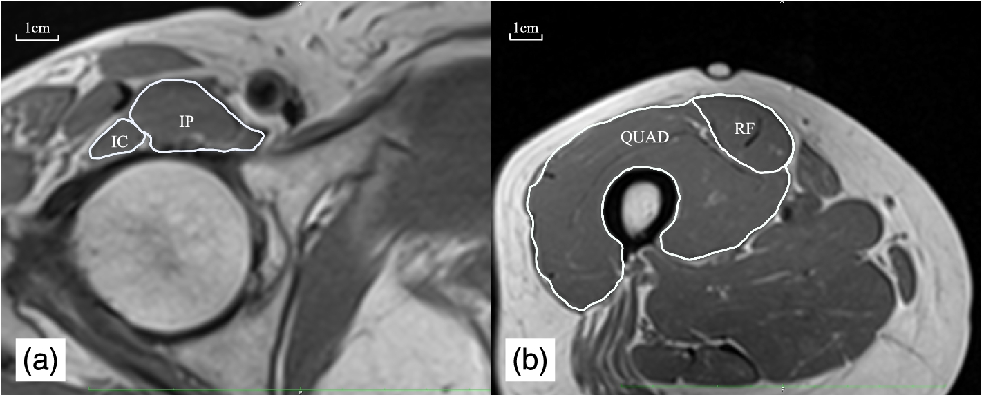 Fig.1