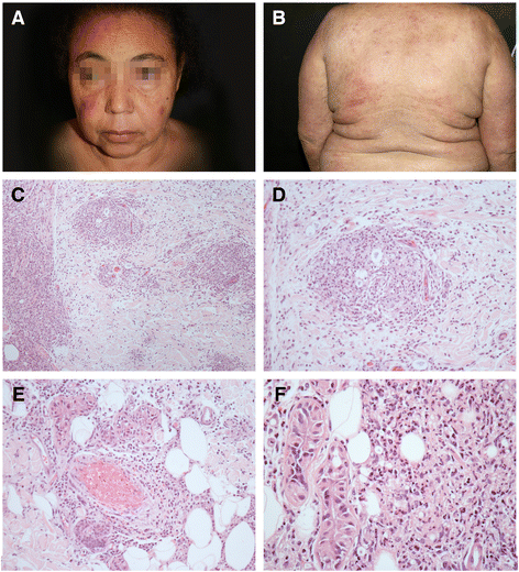 Fig. 1