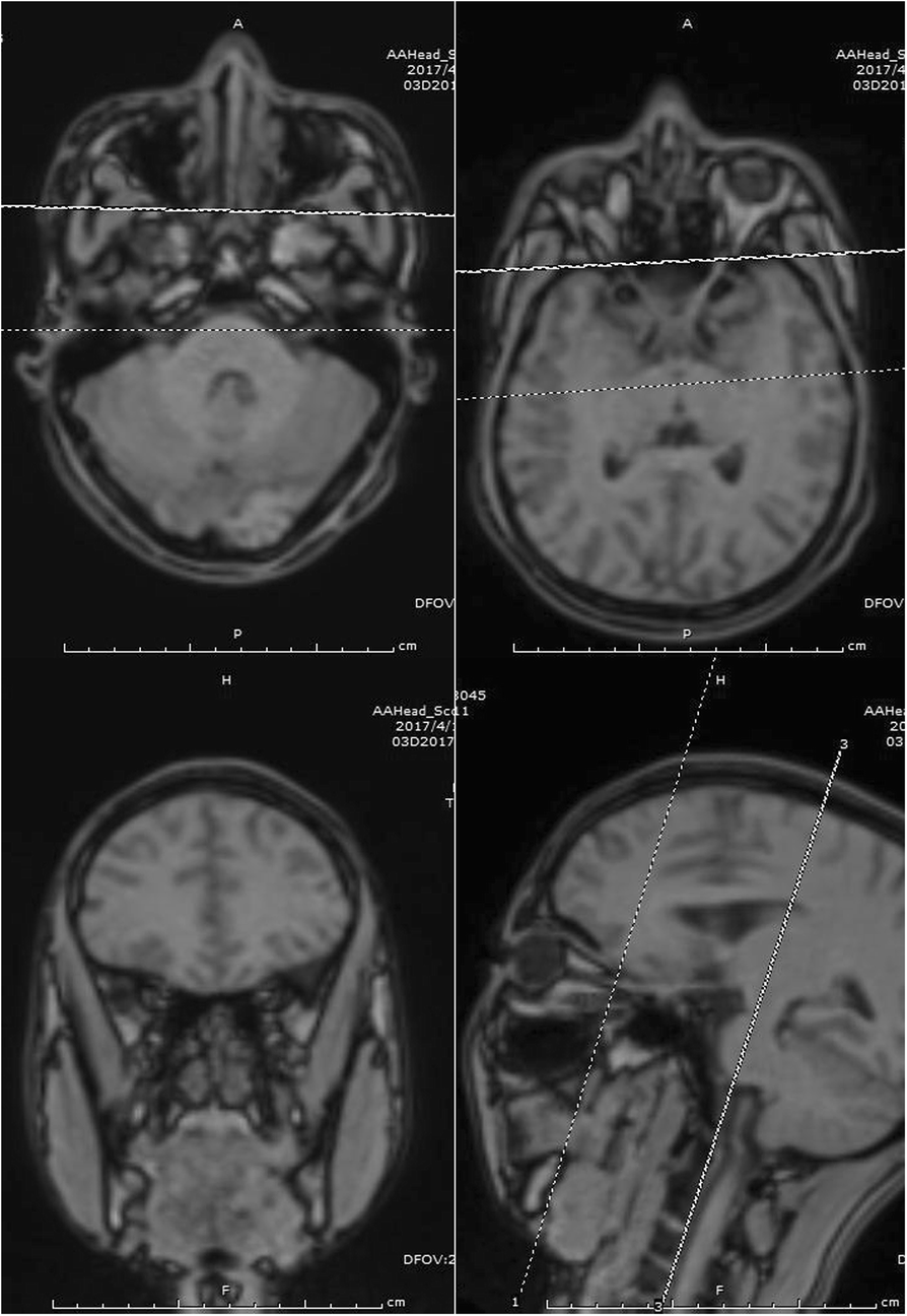 Fig. 1