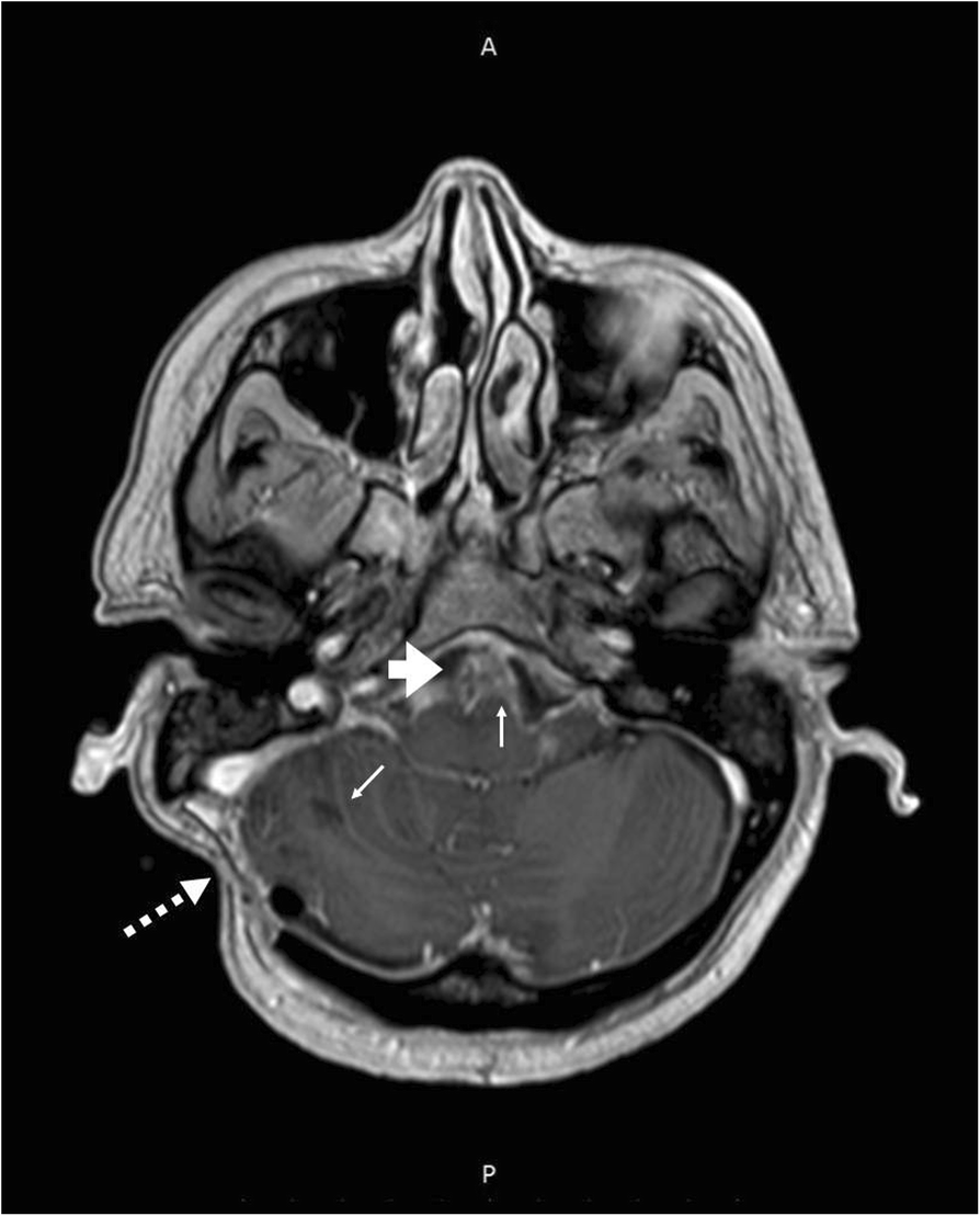 Fig. 1