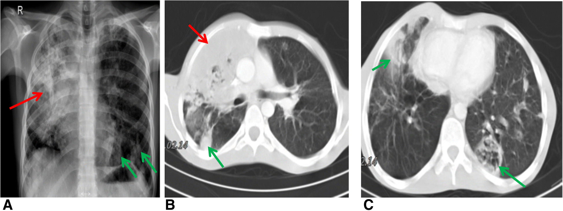 Fig. 1