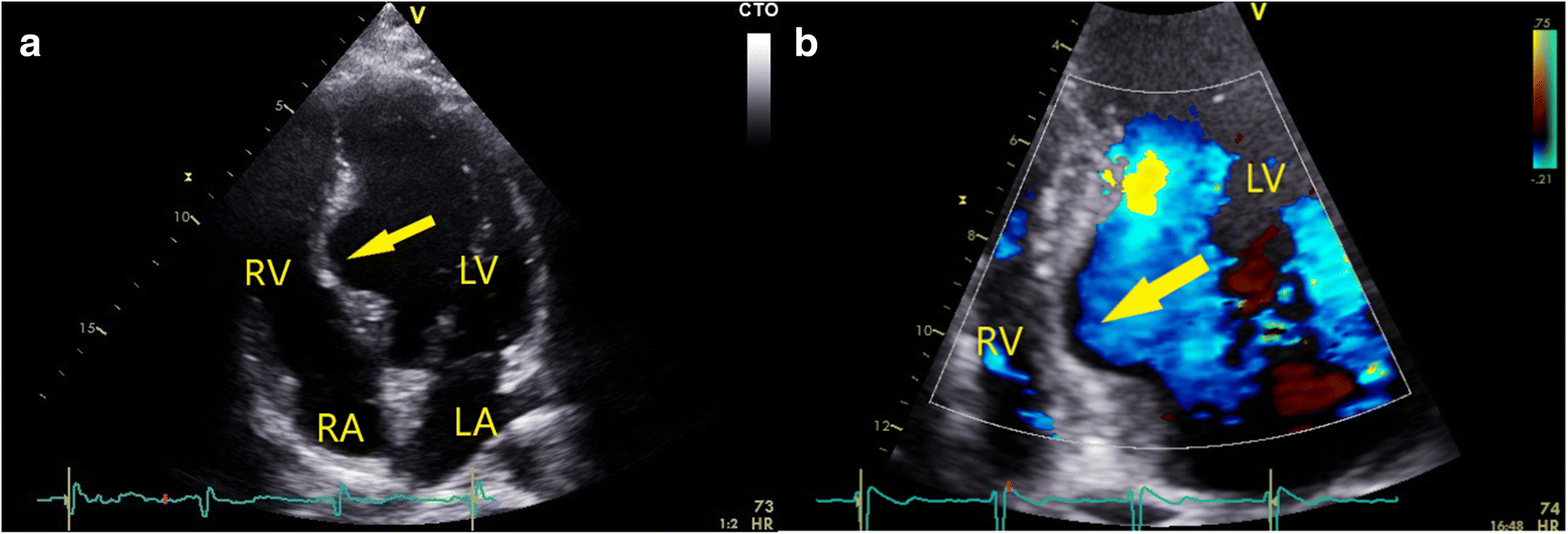 Fig. 4