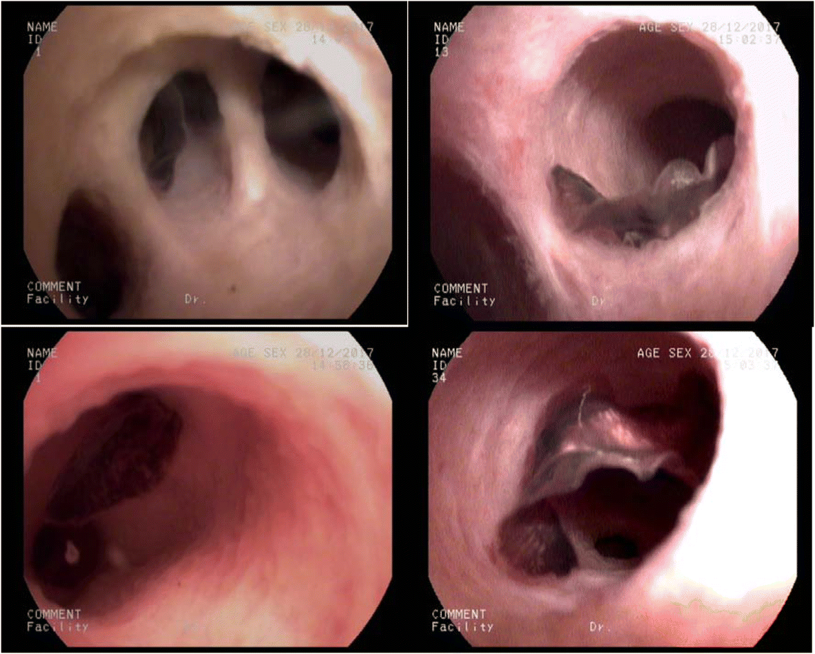 Fig. 5