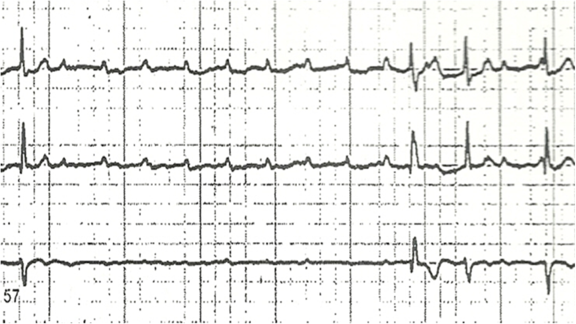 Fig. 2