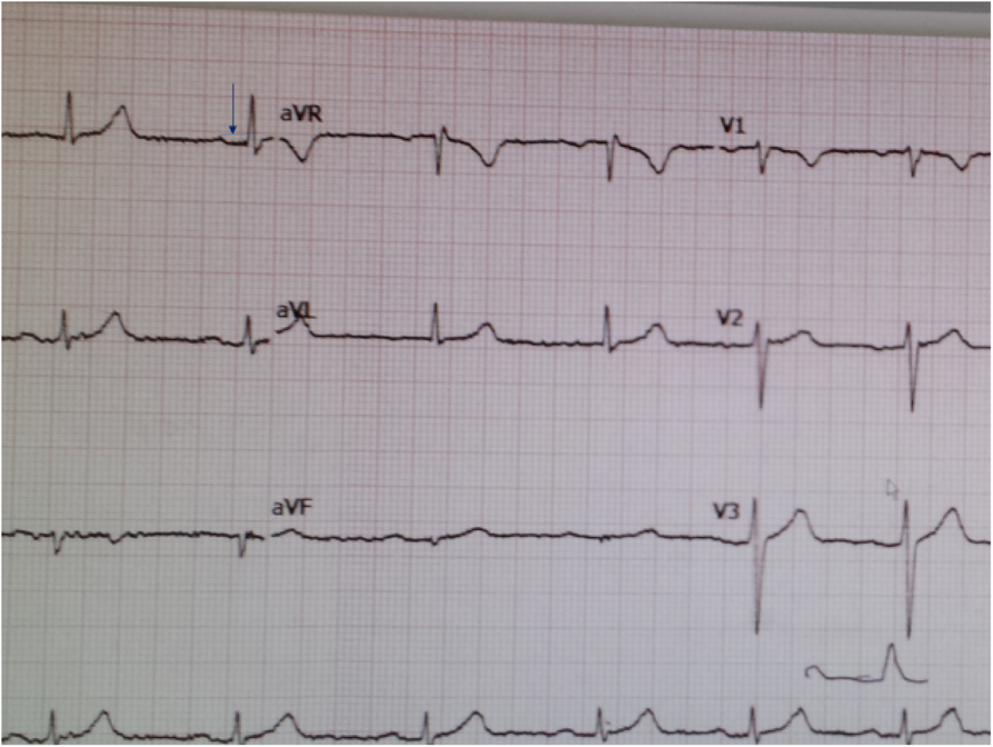 Fig. 3