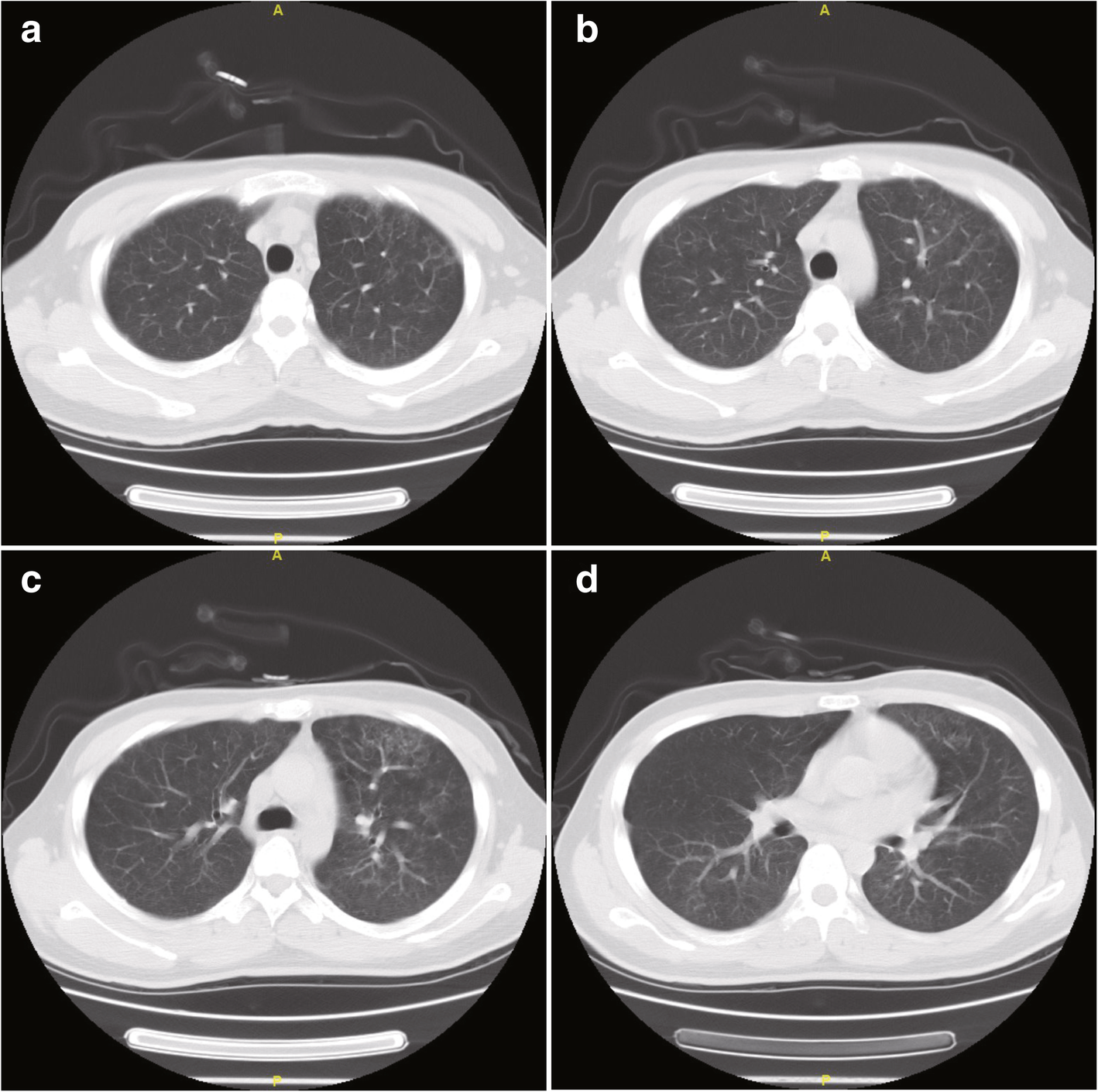 Fig. 4