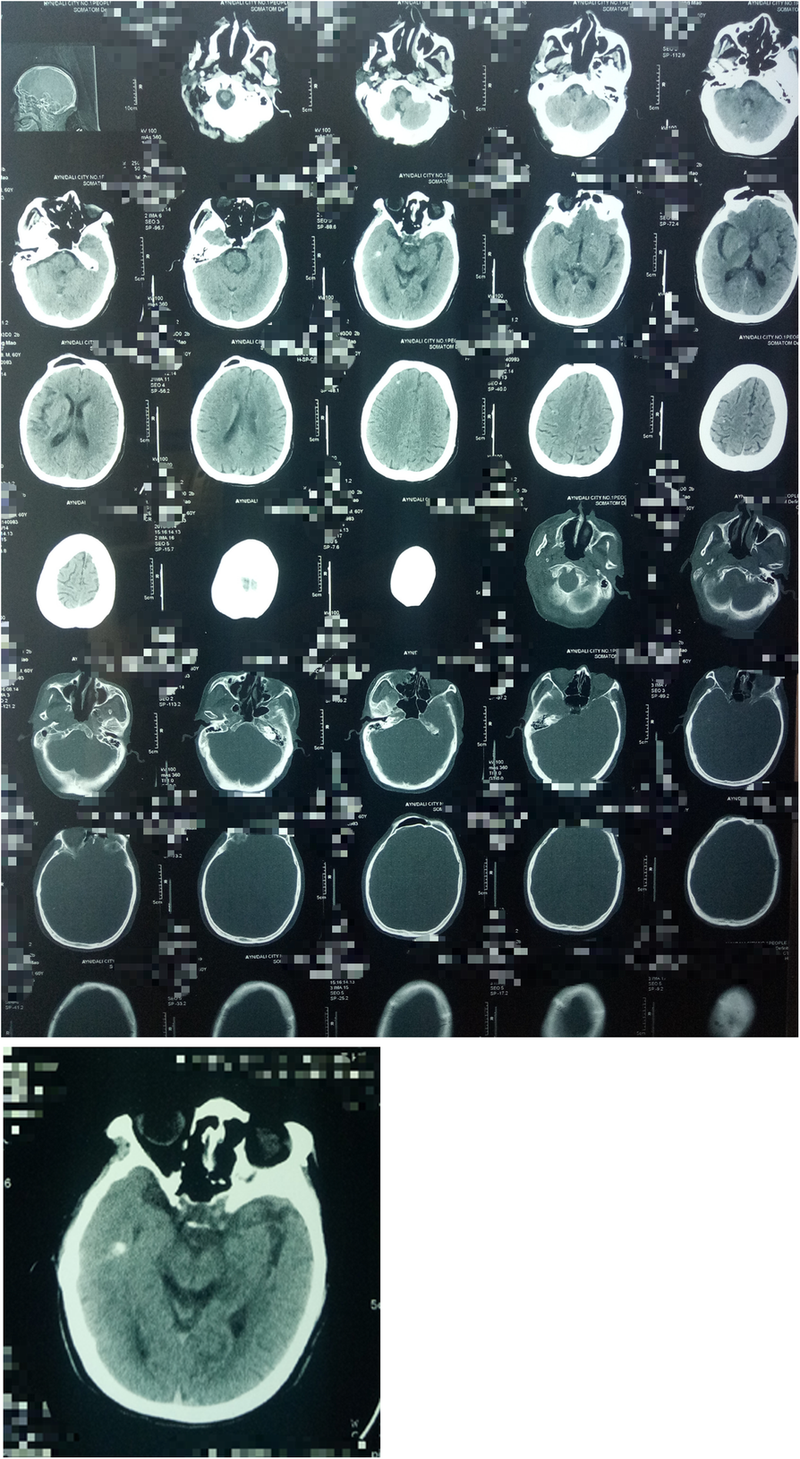 Fig. 2