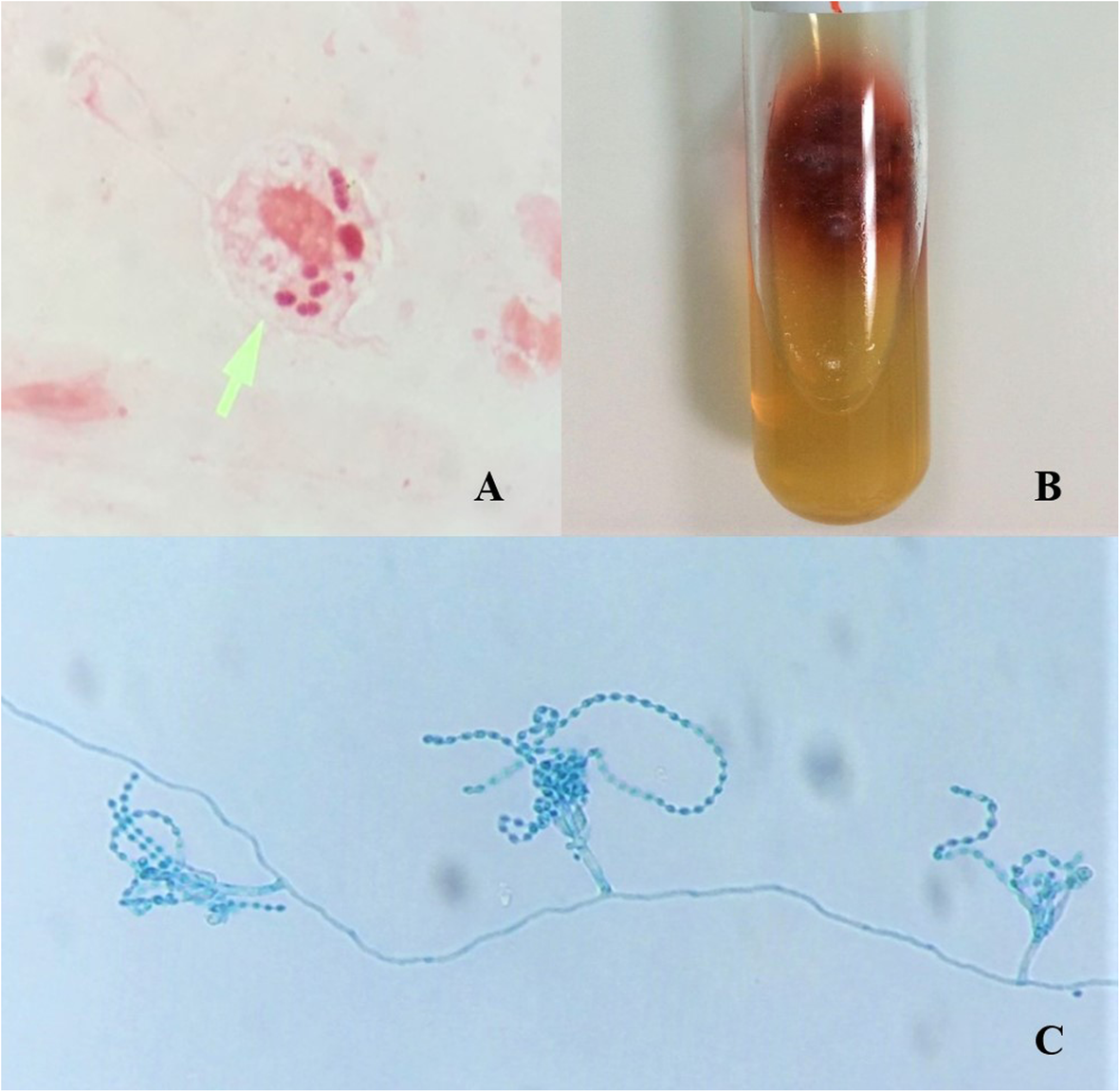 Fig. 2