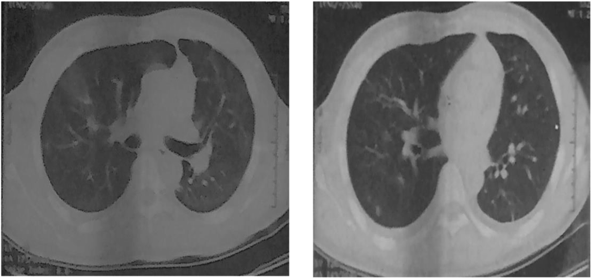 Fig. 5