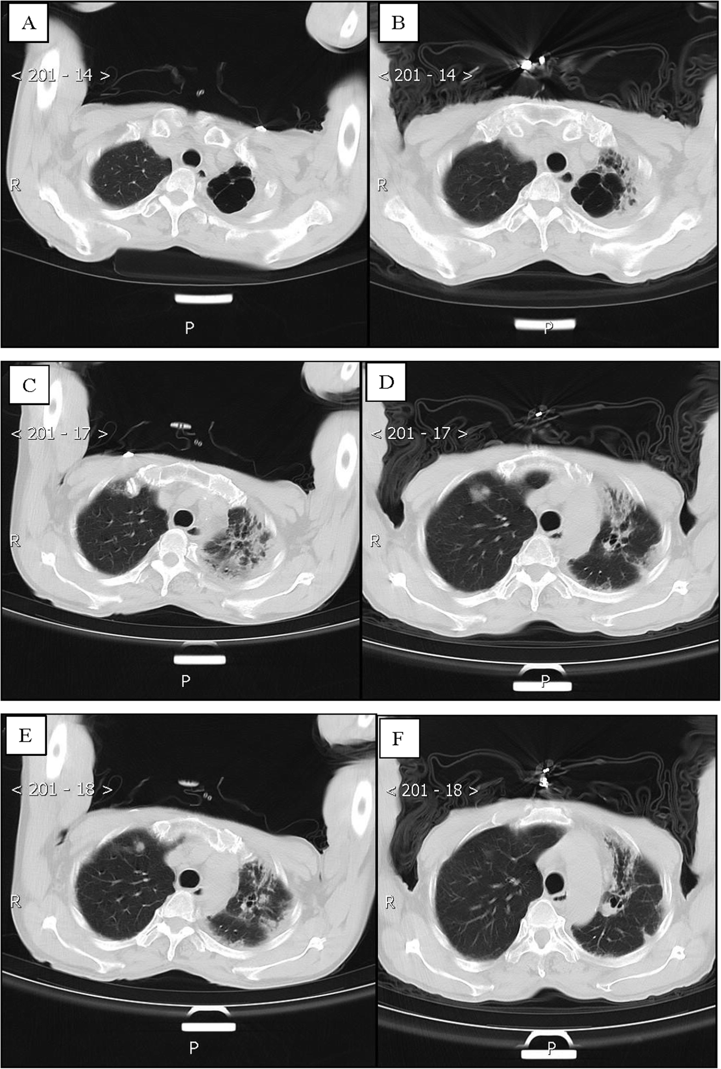 Fig. 4