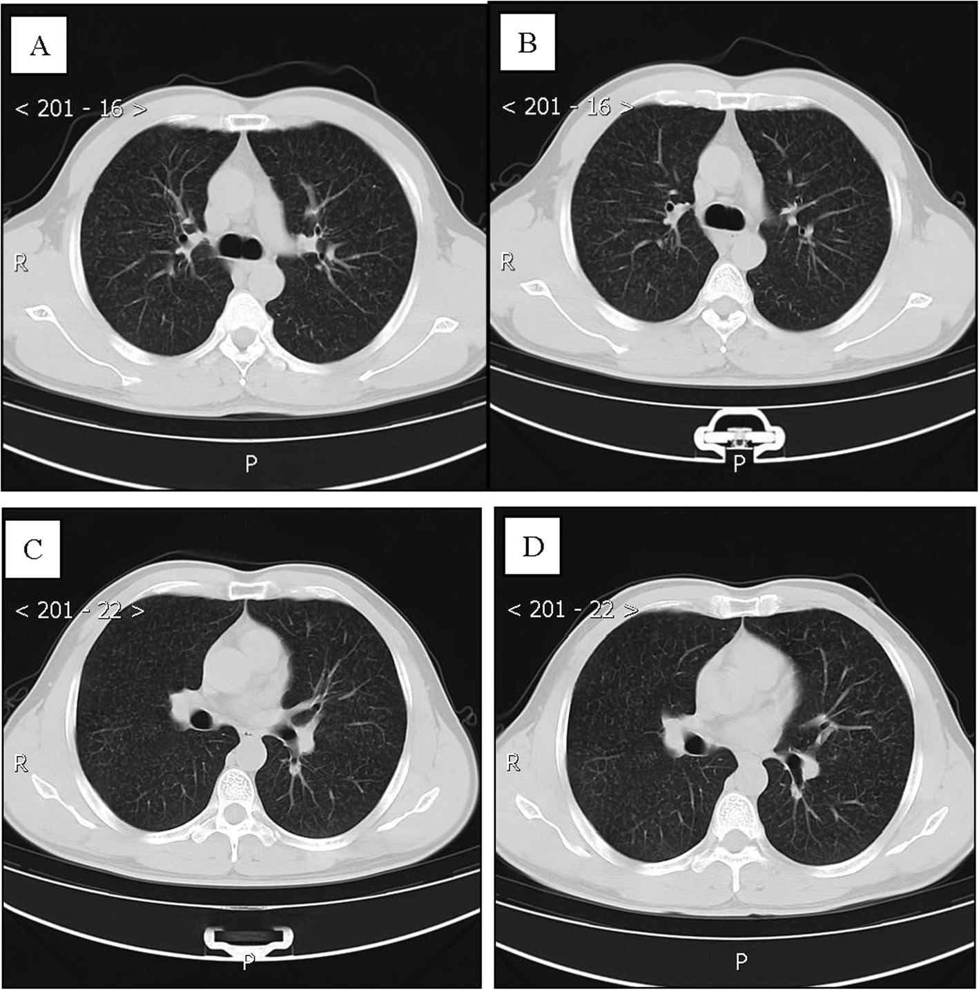 Fig. 5