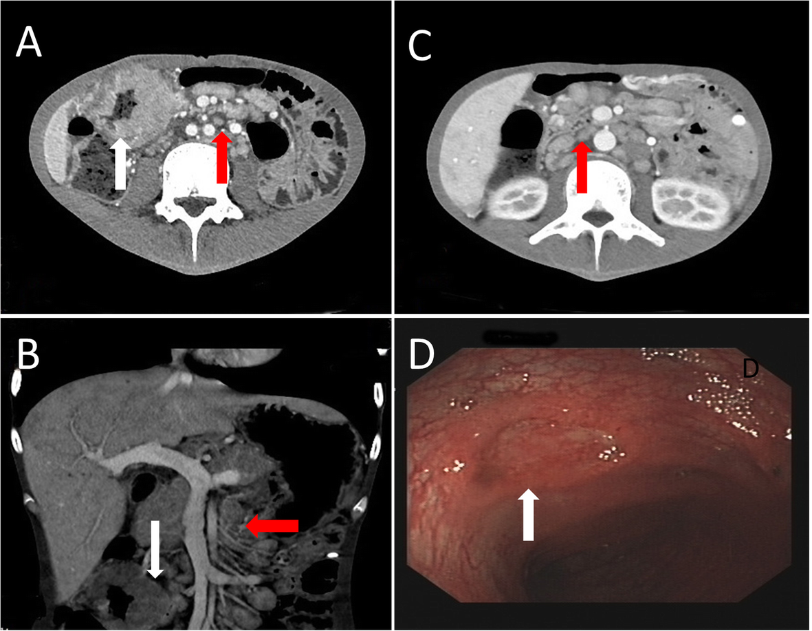 Fig. 1