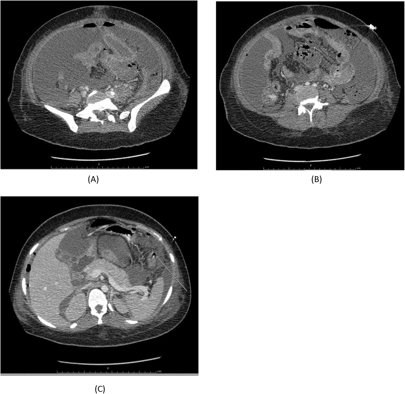 Fig. 1