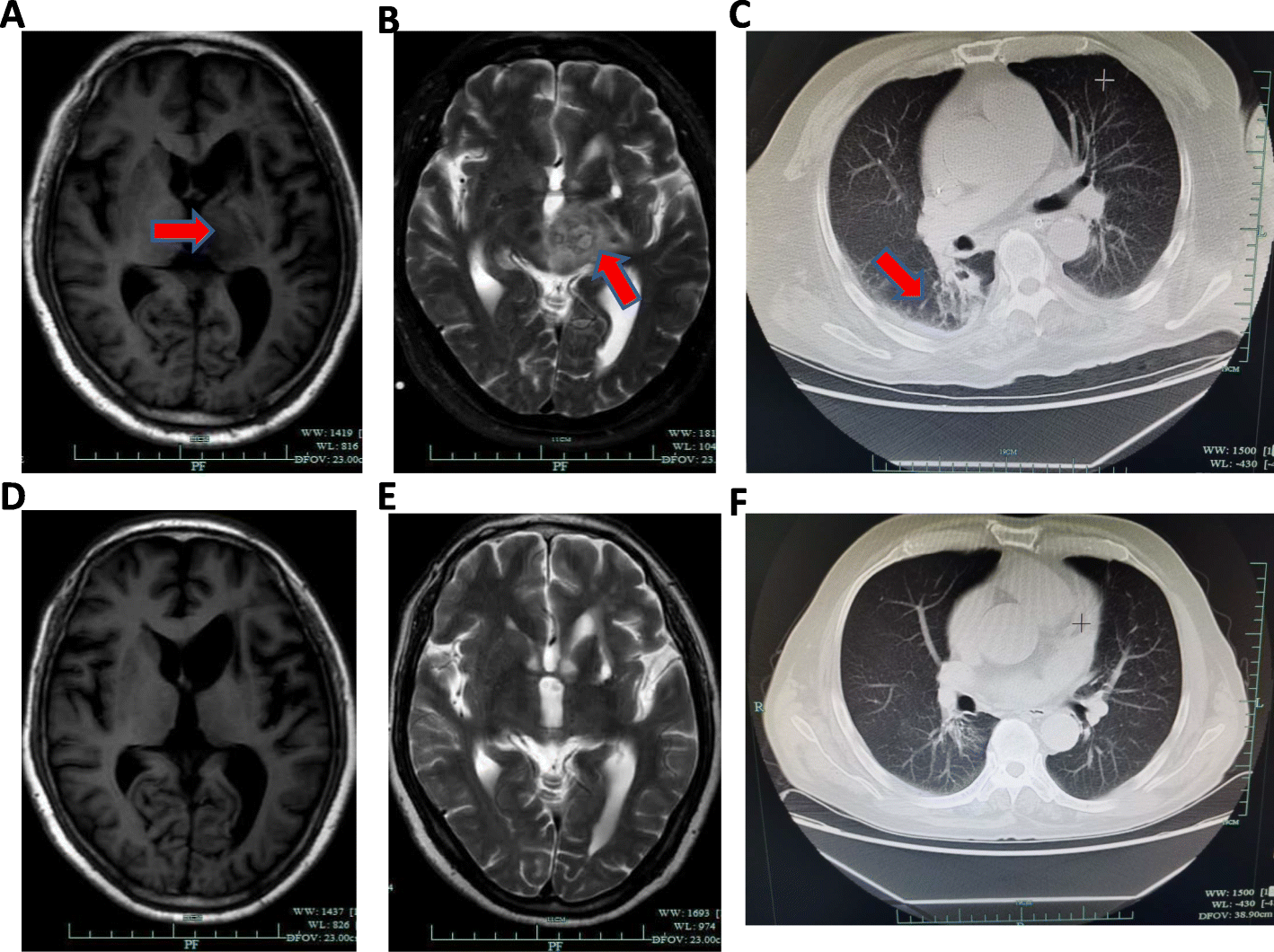 Fig. 2