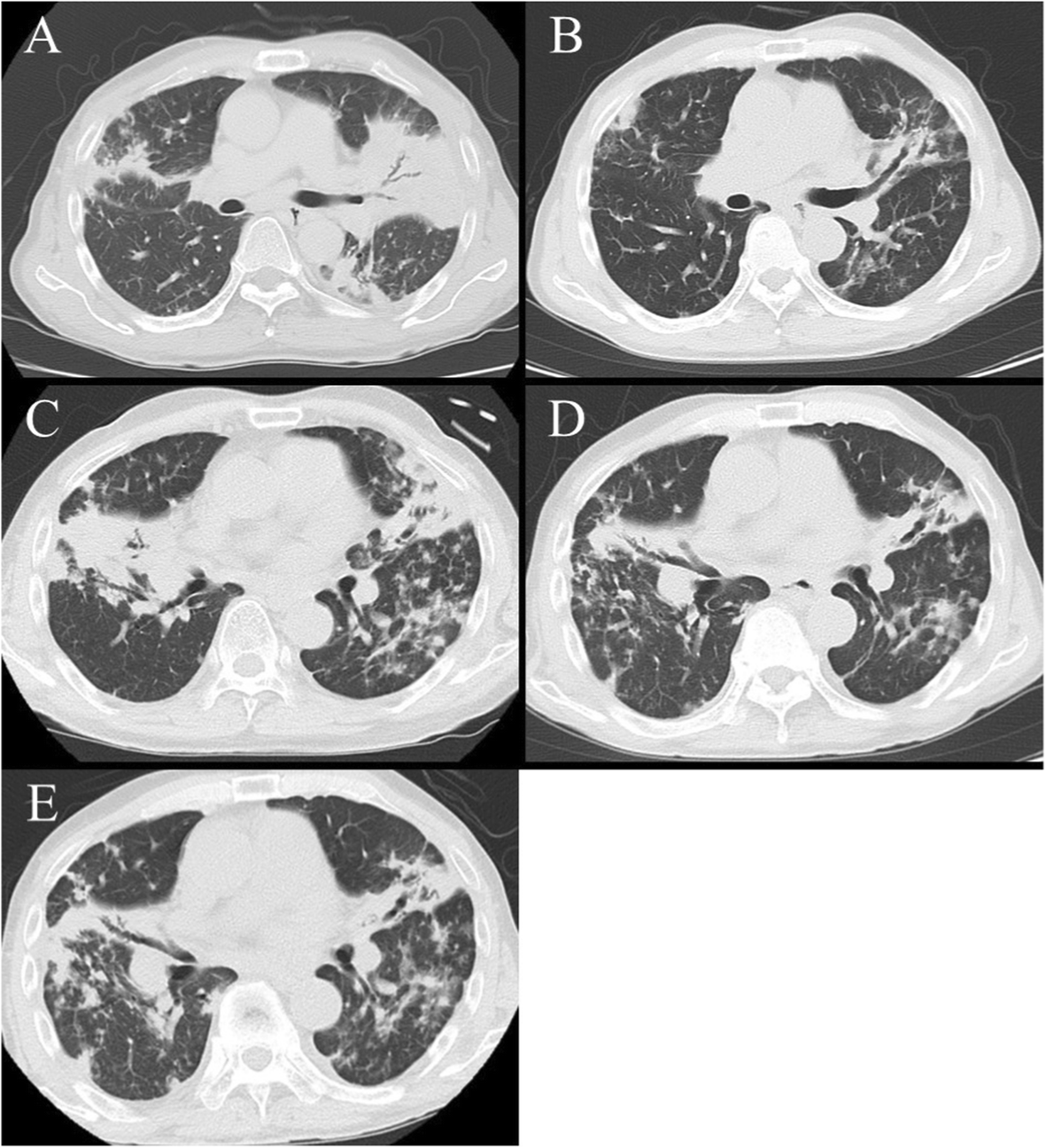 Fig. 1