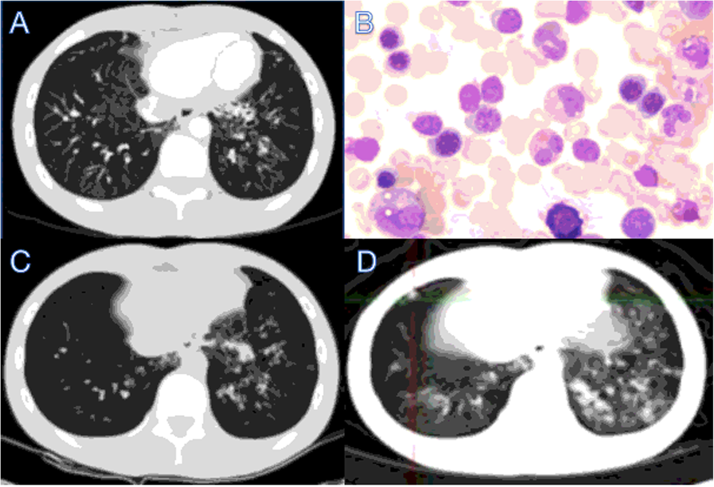 Fig. 1