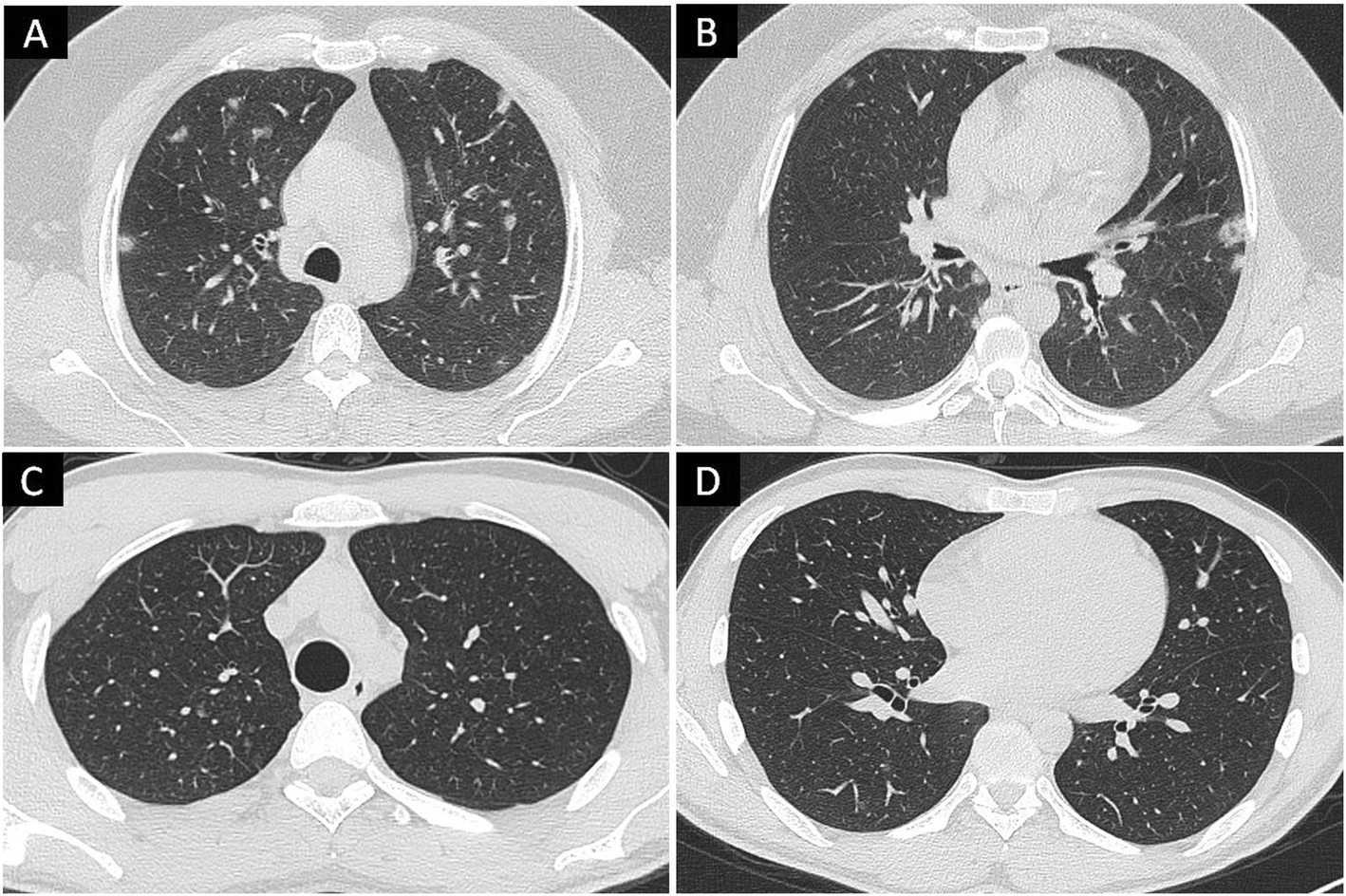 Fig. 4