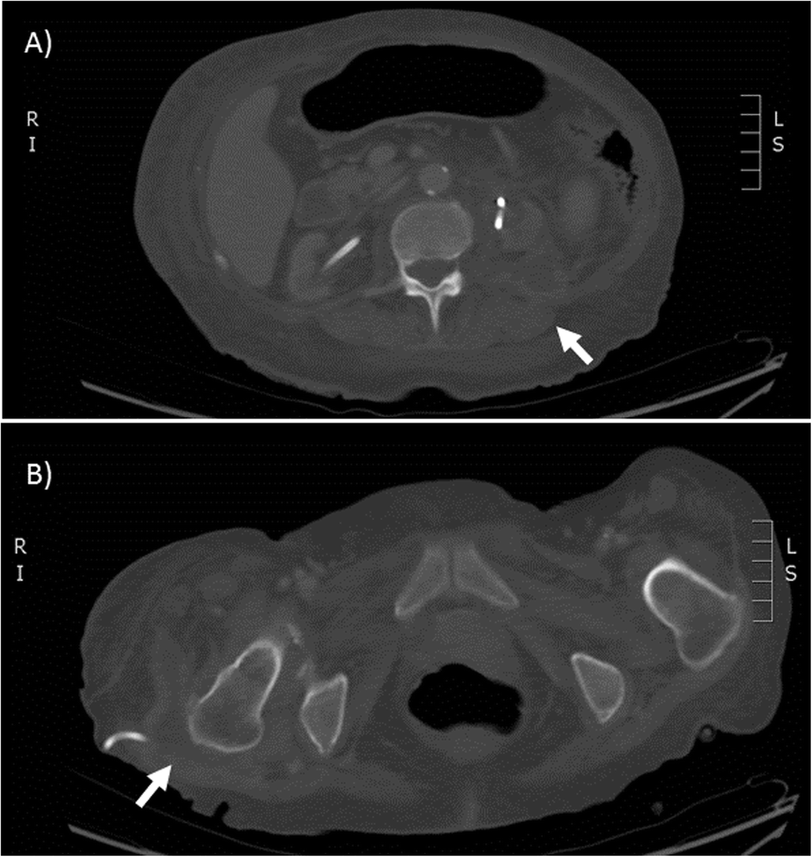 Fig. 1