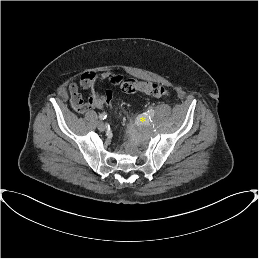 Fig. 1