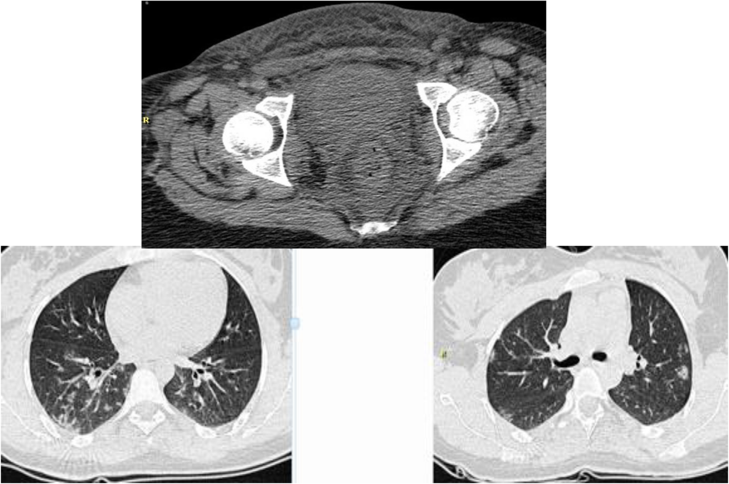 Fig. 2