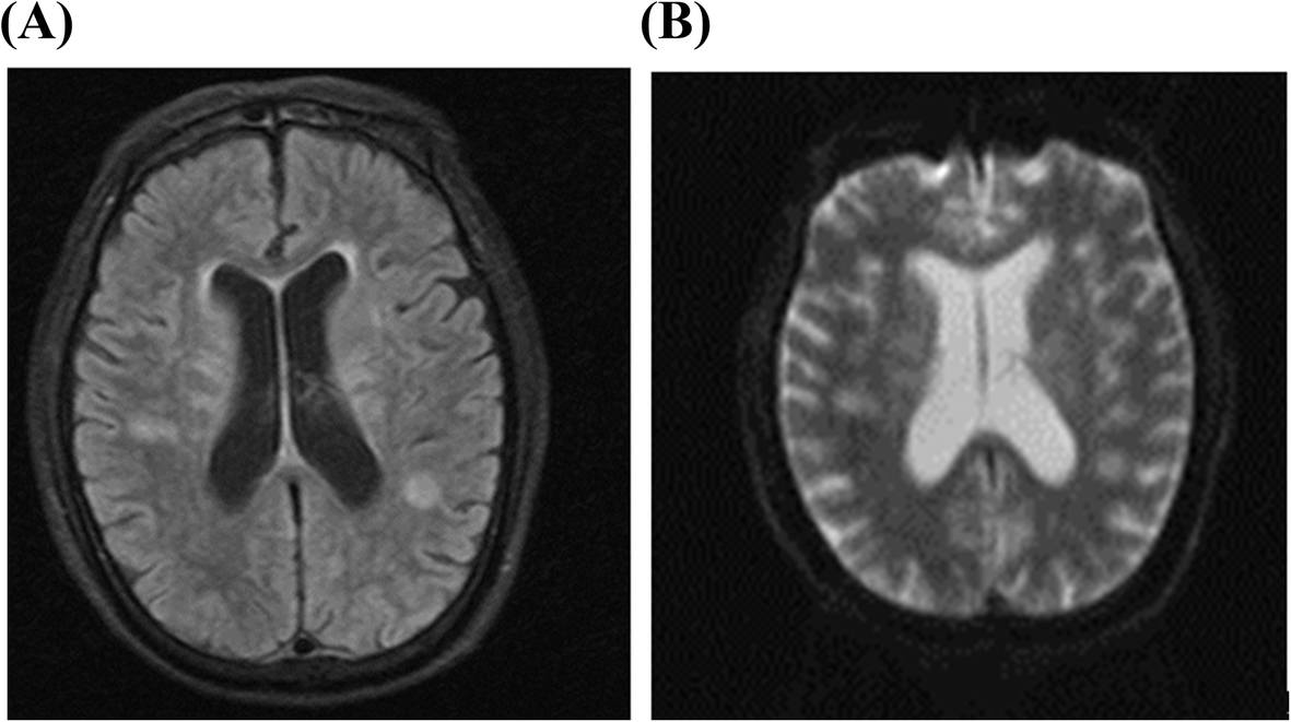 Fig. 1